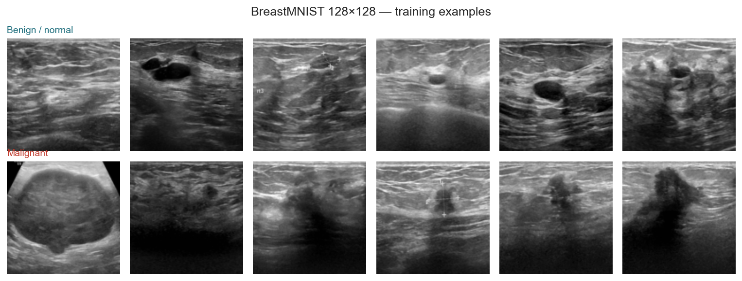 Training examples by class
